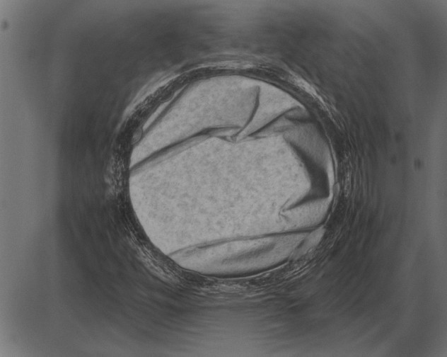 X0000085741448200704091457