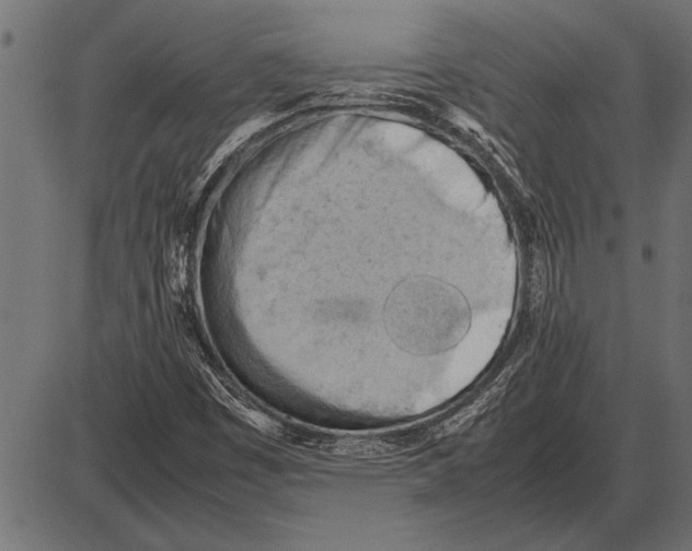 X0000085741449200704091457