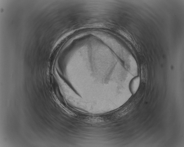 X0000085741452200704091457