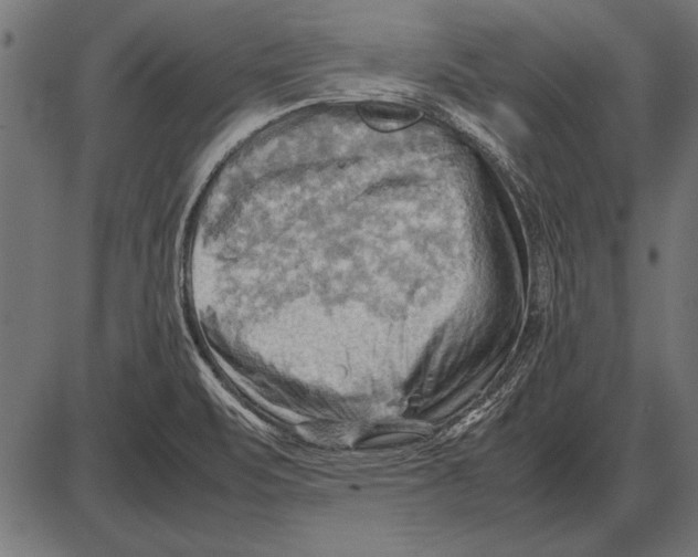 X0000085741471200704091457