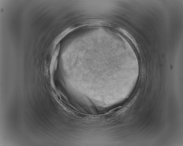 X0000085741481200704091457