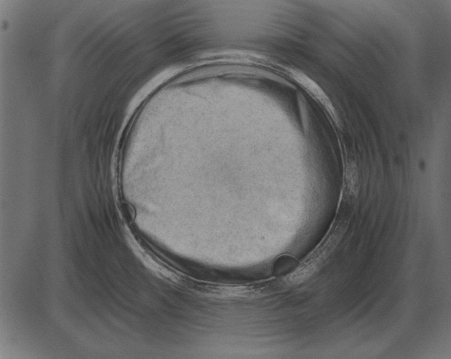 X0000085741482200704091457