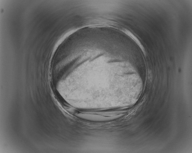 X0000085741485200704091457