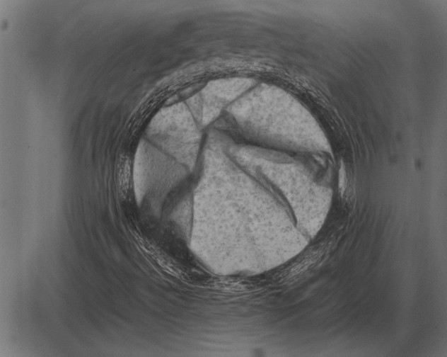 X0000085741492200704091456