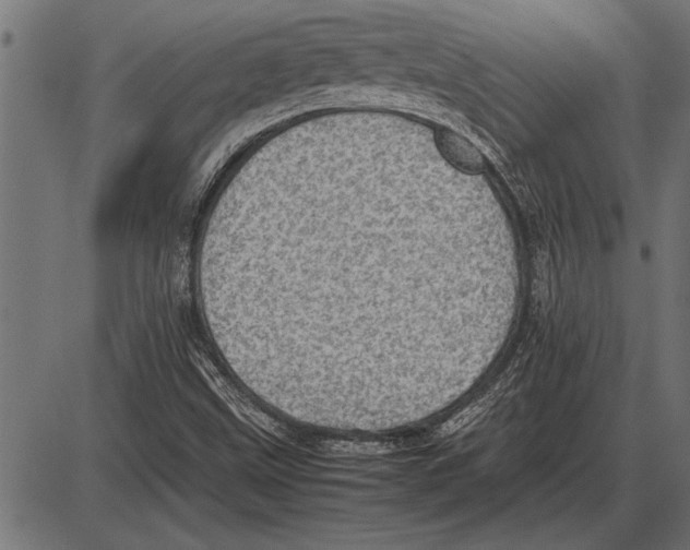 X0000085741499200704091456