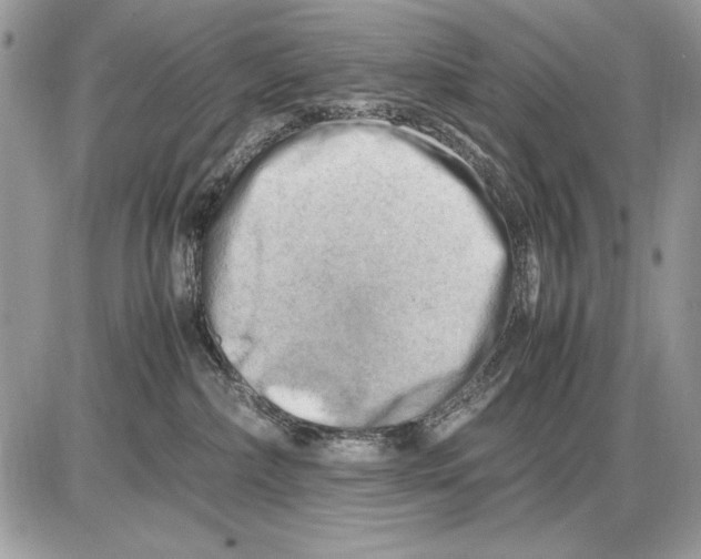 X0000085740236200704131653