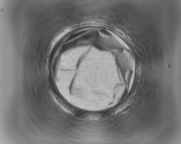 X0000085740248200704131652