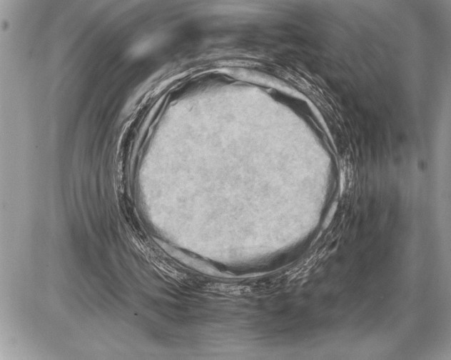 X0000085740339200704131650