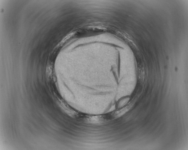 X0000085740382200704131651