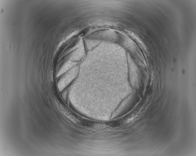 X0000085740399200704131650