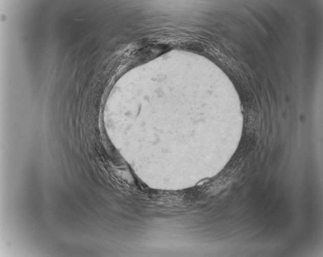 X0000085741153200704131637