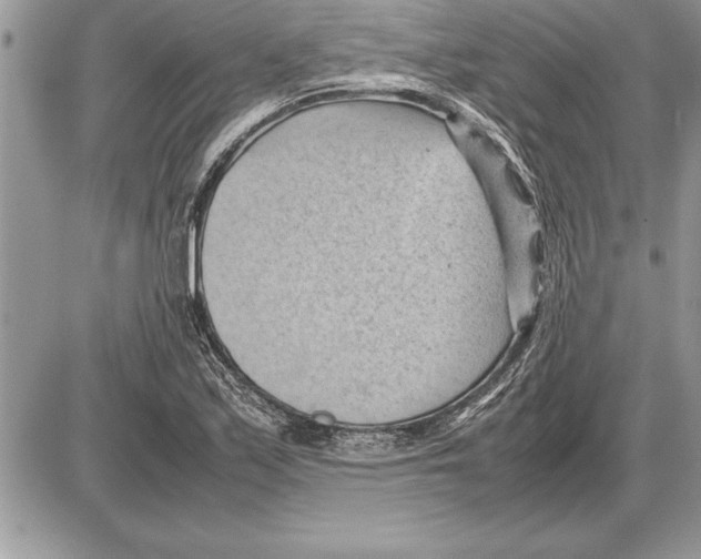 X0000085741171200704131637
