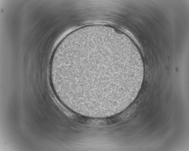 X0000085741187200704131637