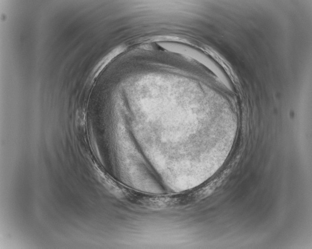 X0000085741193200704131637