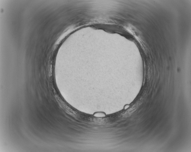 X0000085741459200704131632