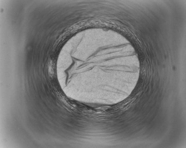 X0000085741490200704131631