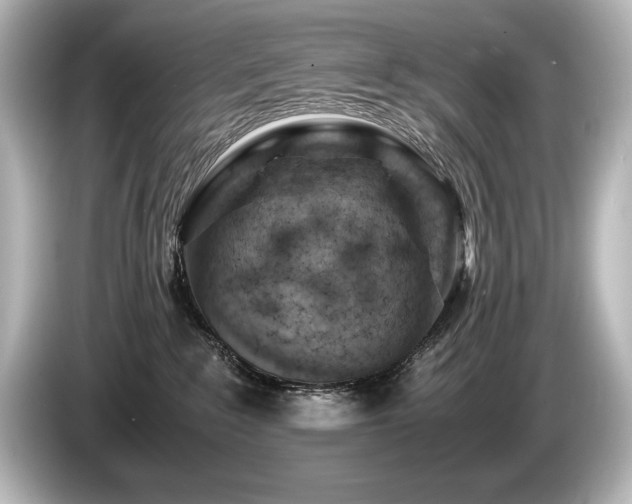 X0000085750235200703161102