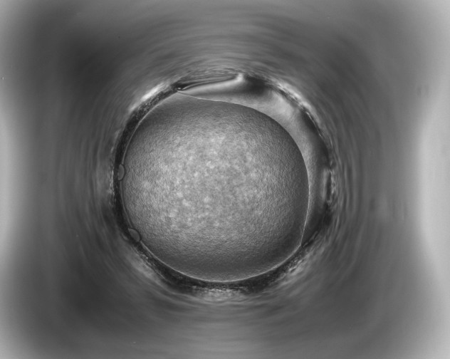X0000085750399200703161059