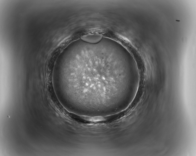 X0000085751399200703161044