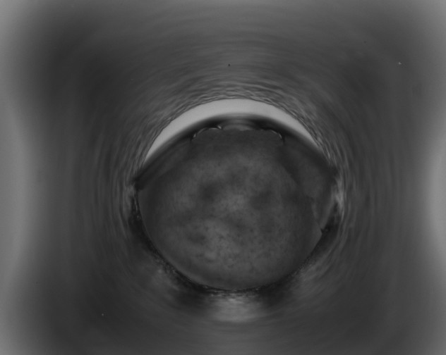 X0000085750235200703231139