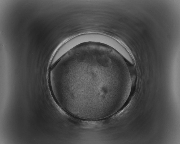 X0000085751197200703231125