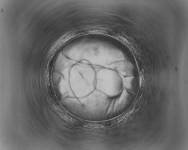 X0000085750339200703301408