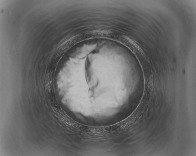 X0000085751015200703301356