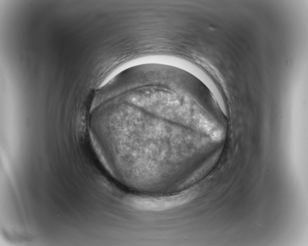 X0000085750017200704091324