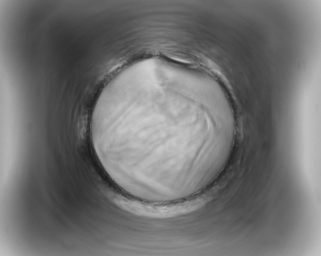 X0000085750018200704091324