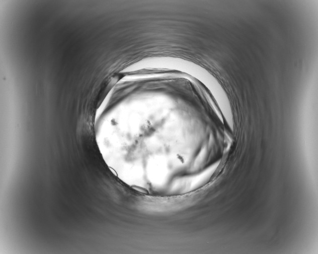 X0000085750045200704091324