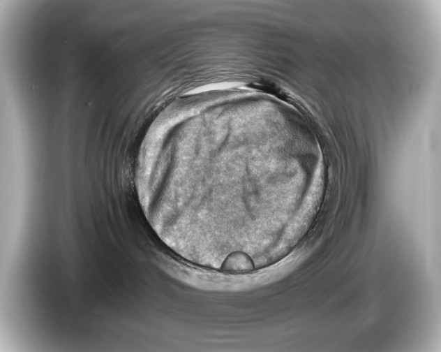 X0000085750048200704091324