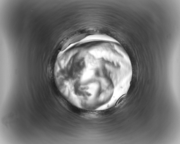 X0000085750086200704091324