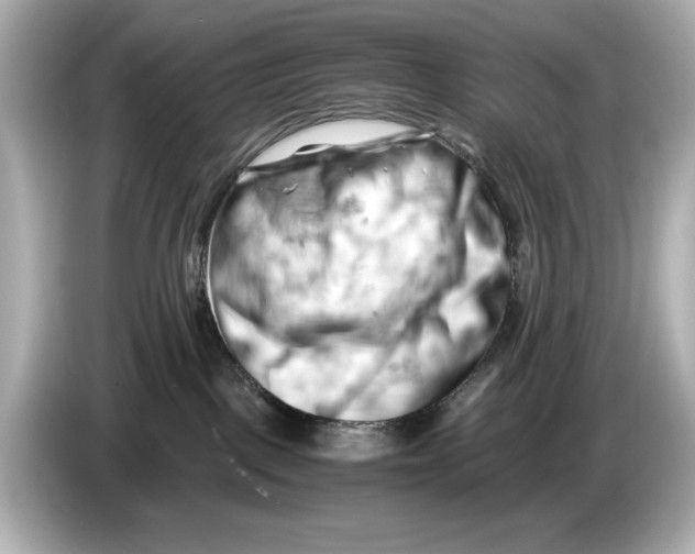 X0000085750093200704091324