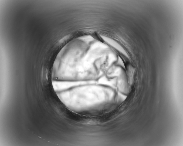 X0000085750115200704091323