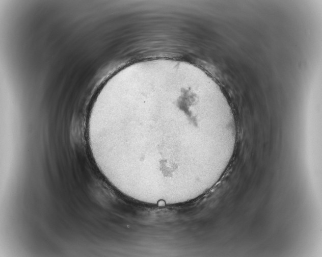 X0000085750146200704091322