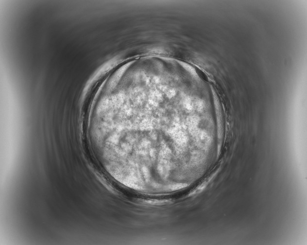 X0000085750149200704091322