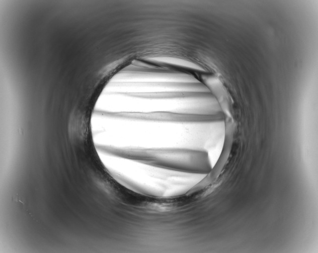 X0000085750164200704091322