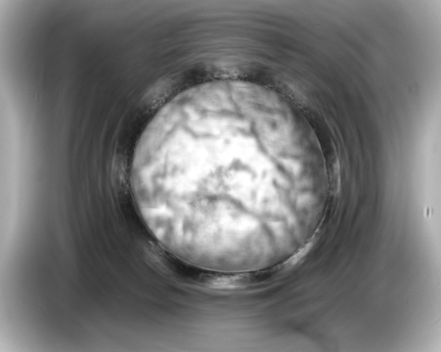 X0000085750178200704091323