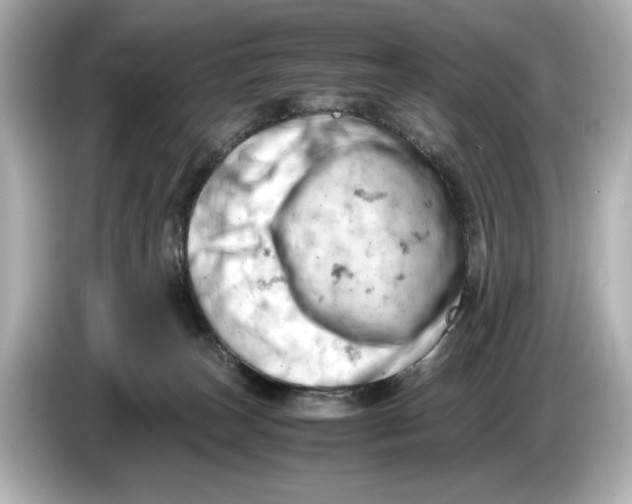 X0000085750179200704091323