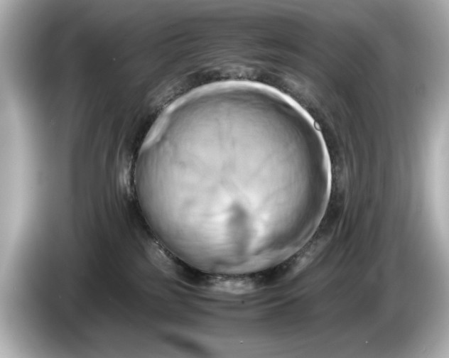 X0000085750185200704091323