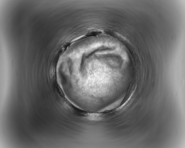 X0000085750192200704091323