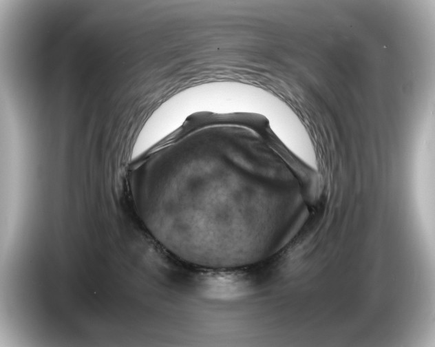 X0000085750235200704091322