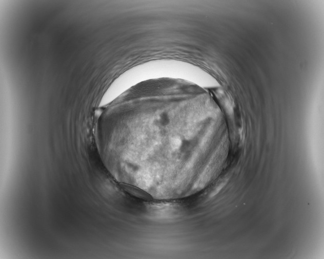 X0000085750237200704091322