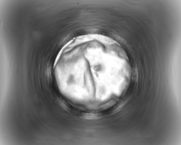 X0000085750238200704091322