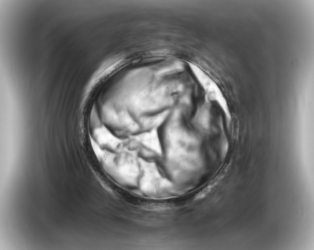 X0000085750245200704091321