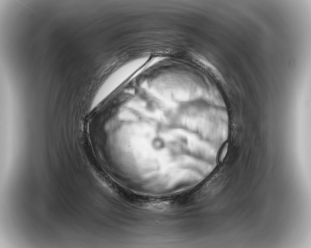 X0000085750257200704091321