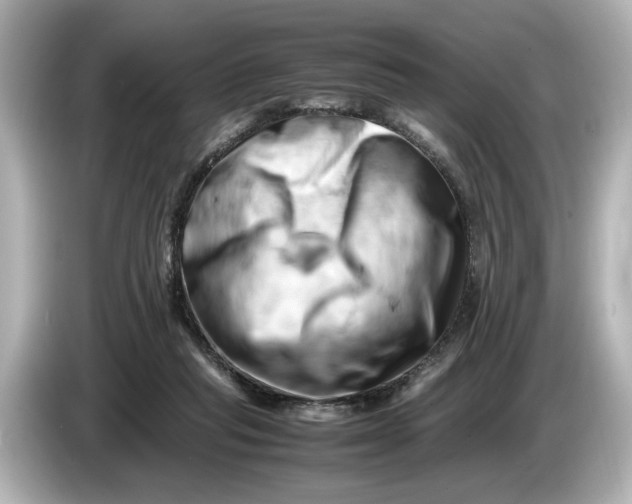 X0000085750261200704091321