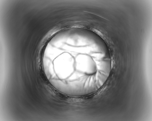 X0000085750339200704091320