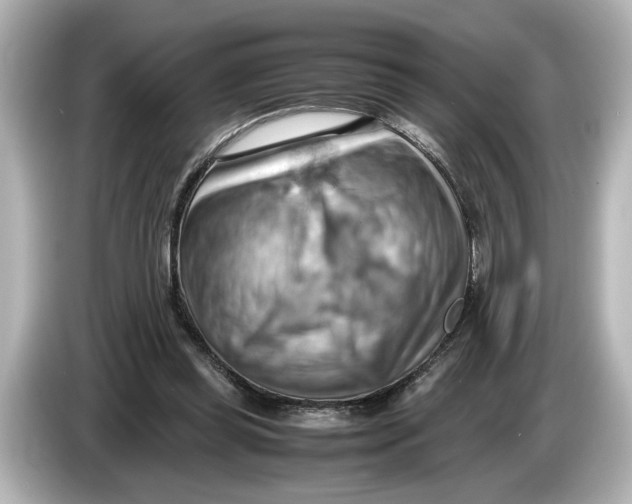 X0000085750349200704091320