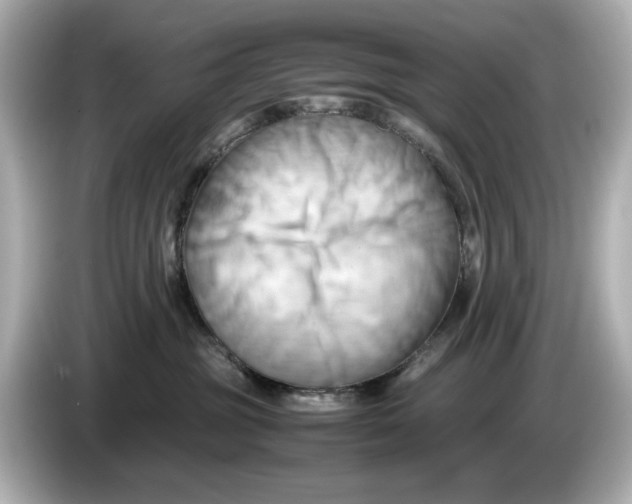 X0000085750381200704091320